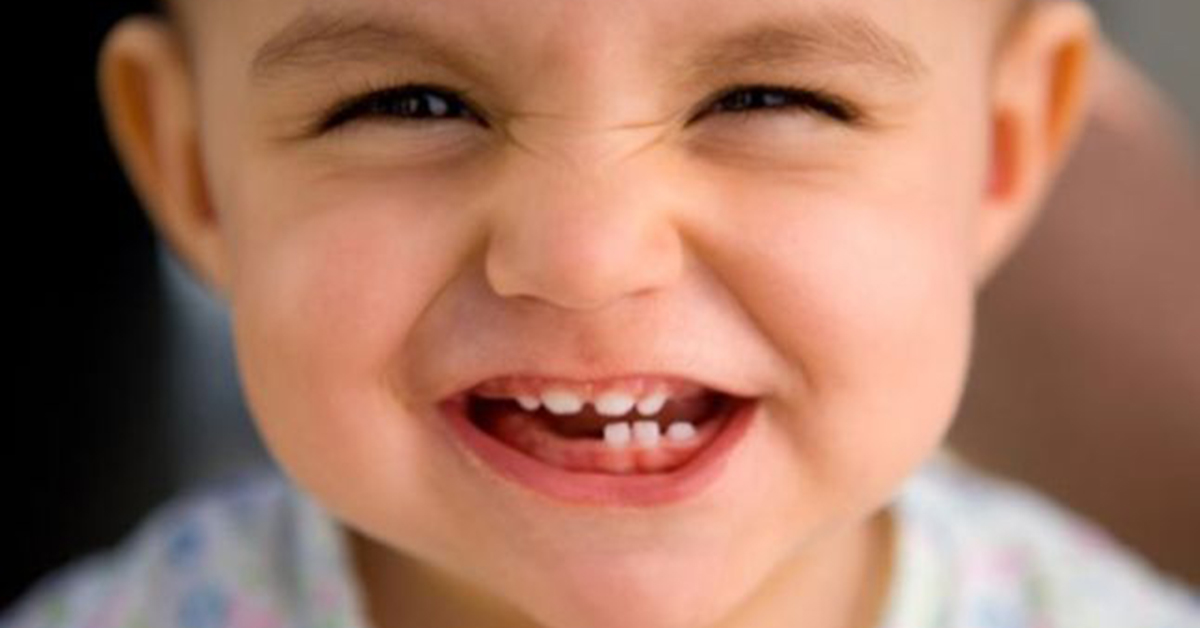 Зубы у ребенка 3 лет фото