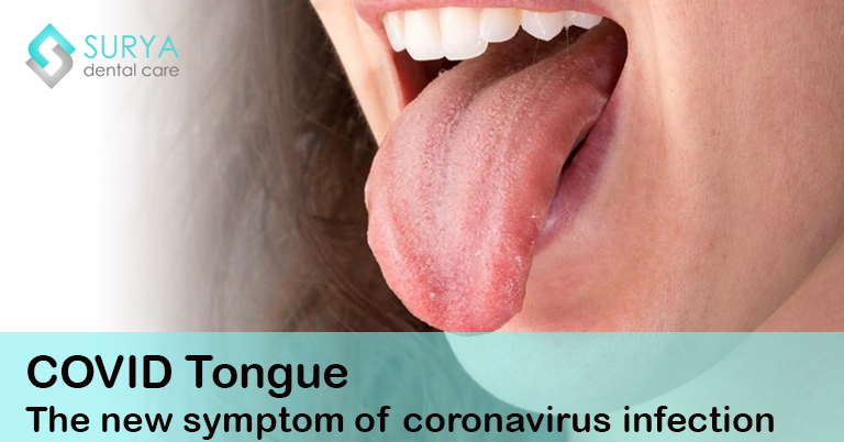 covid vaccine tongue side effect