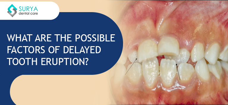 5-factors-behind-delayed-teeth-eruption